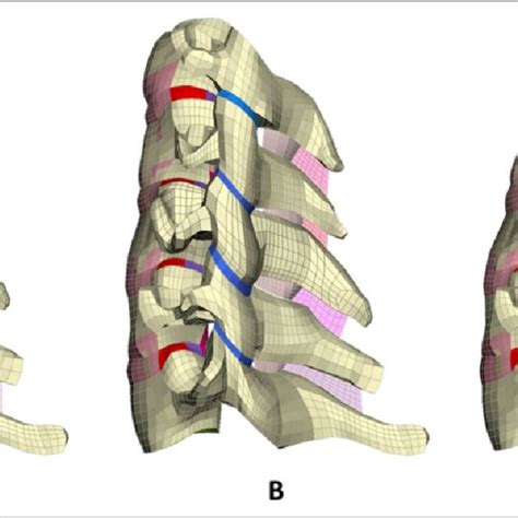 Influence Of Cervical Spine Curvature On Range Of Motion Under 